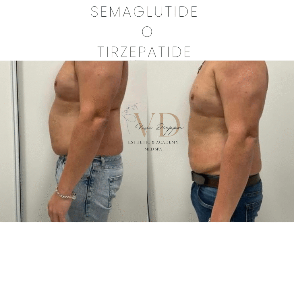 SEMAGLUTIDE O TIRZEPATIDE.zip - 1